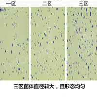 细菌在平板三区的形态特征对比/