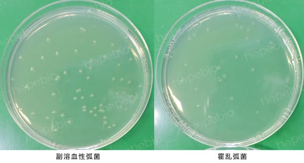 碱性胆盐琼脂微生物质控结果